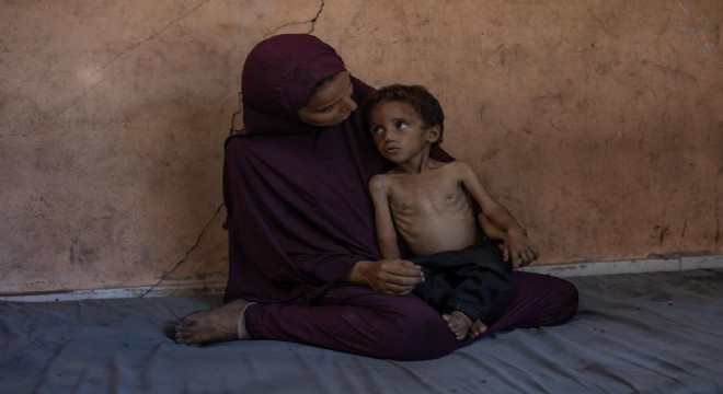 Gazze’de açlıktan ölenlerin sayısı 127’ye çıktı